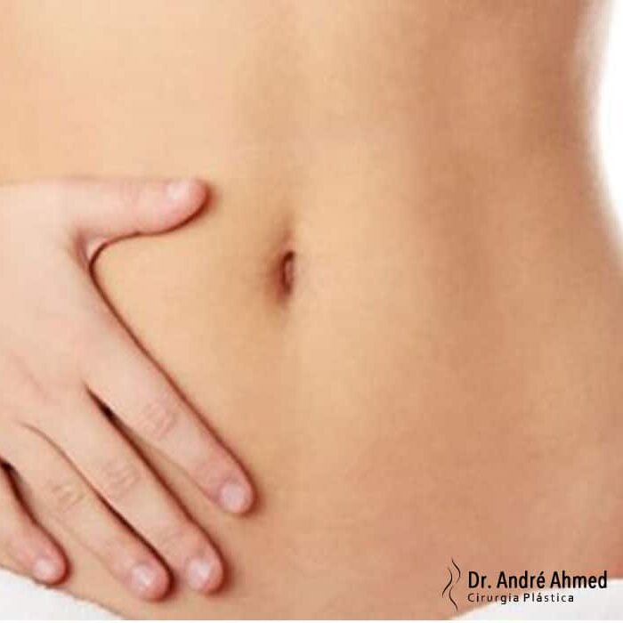 Referência visual de abdominoplastia