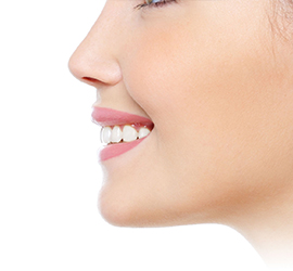 Rinoplastia