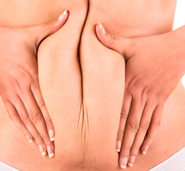 Abdominoplastia