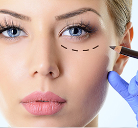 Blefaroplastia