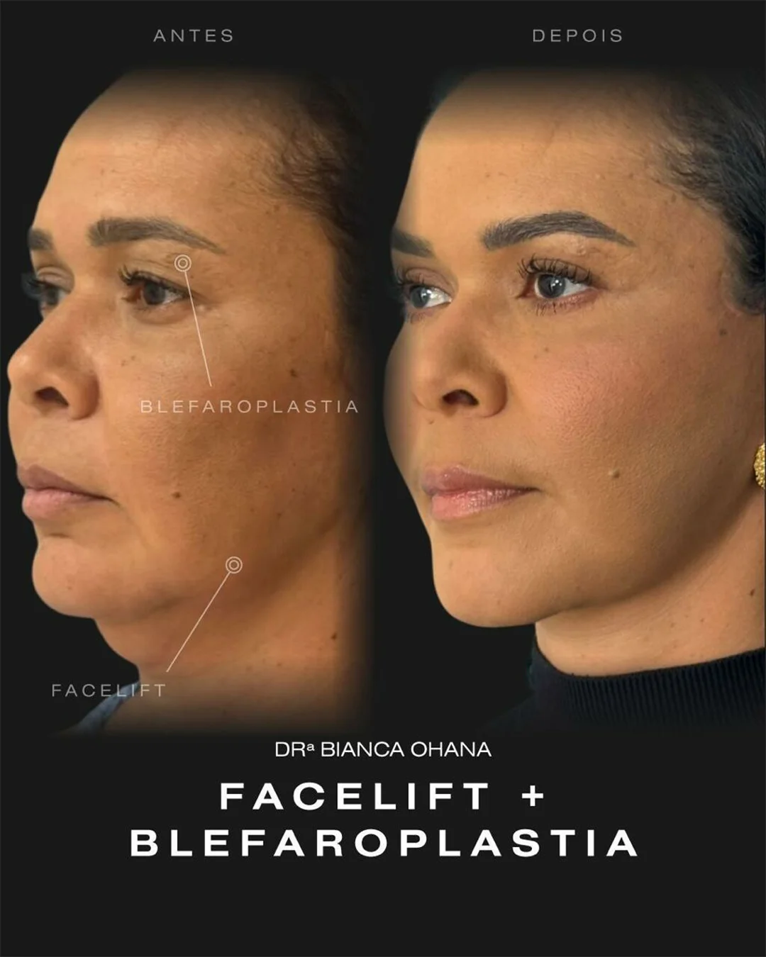 Registro clínico de análise facial em consulta