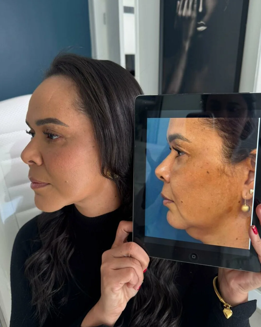 Registro visual usado em avaliação estética facial