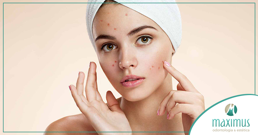 Conteúdo visual sobre acne