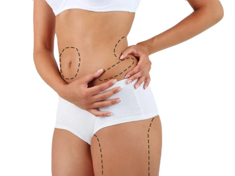 Imagem institucional sobre lipoaspiracao