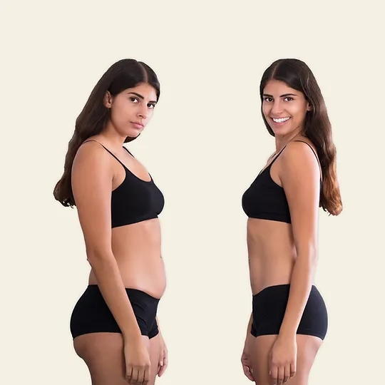 Lipoaspiração