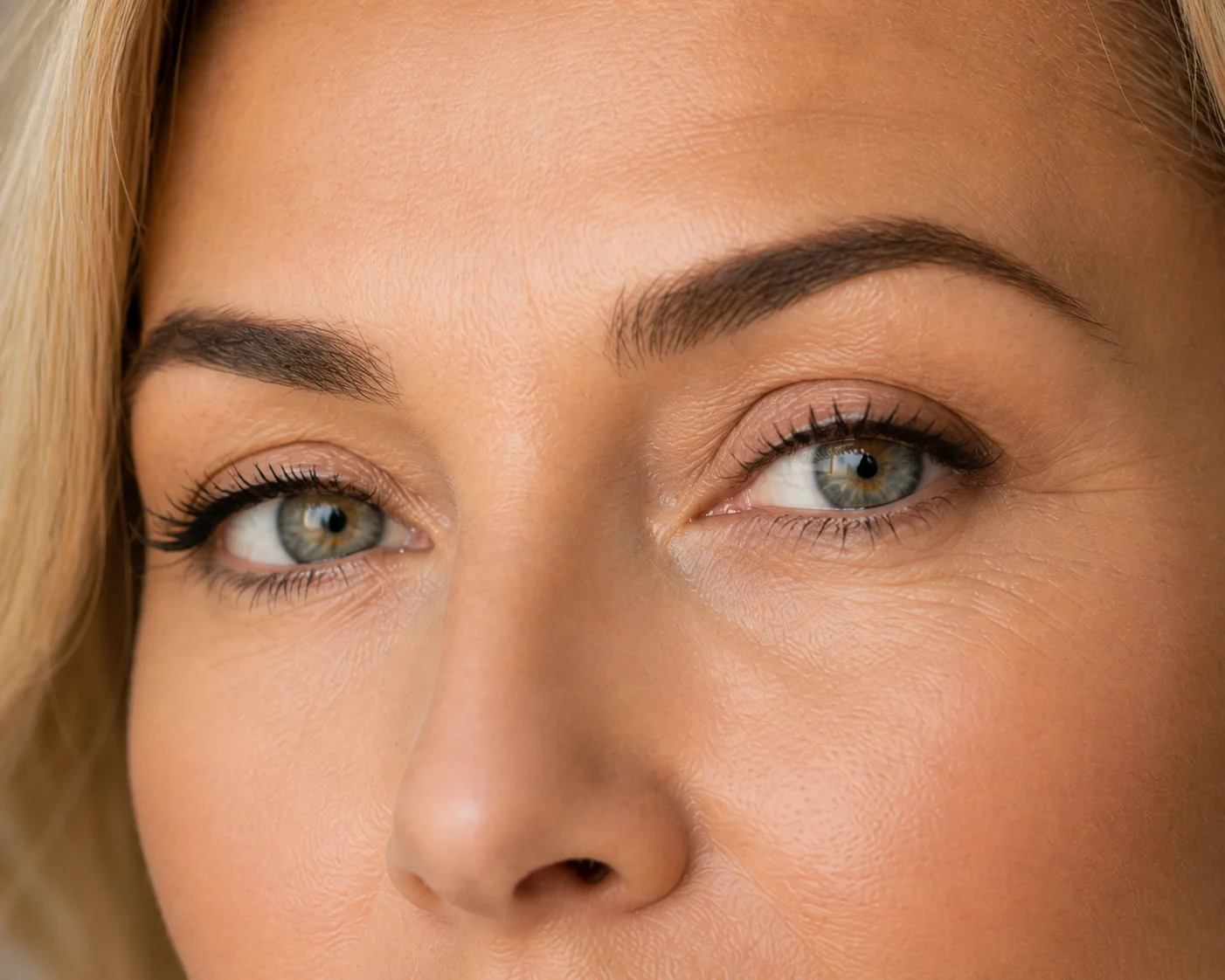 Blefaroplastia