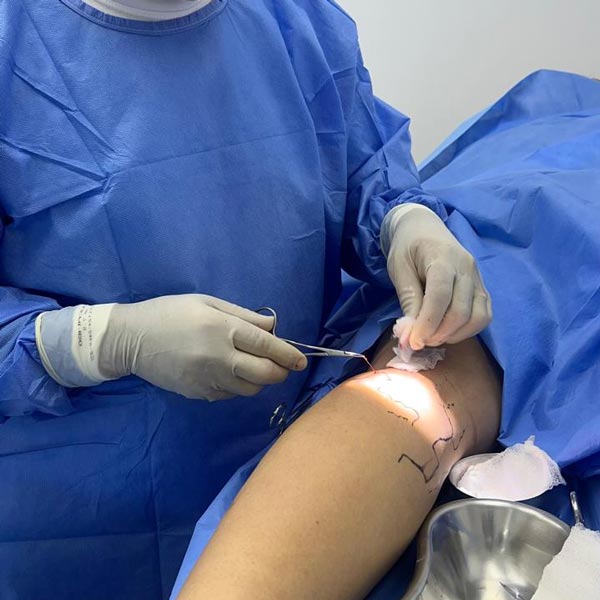 Procedimento vascular