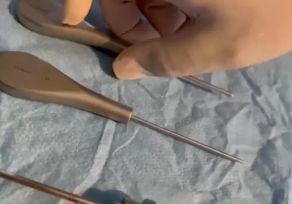 Cirurgia da ATM
