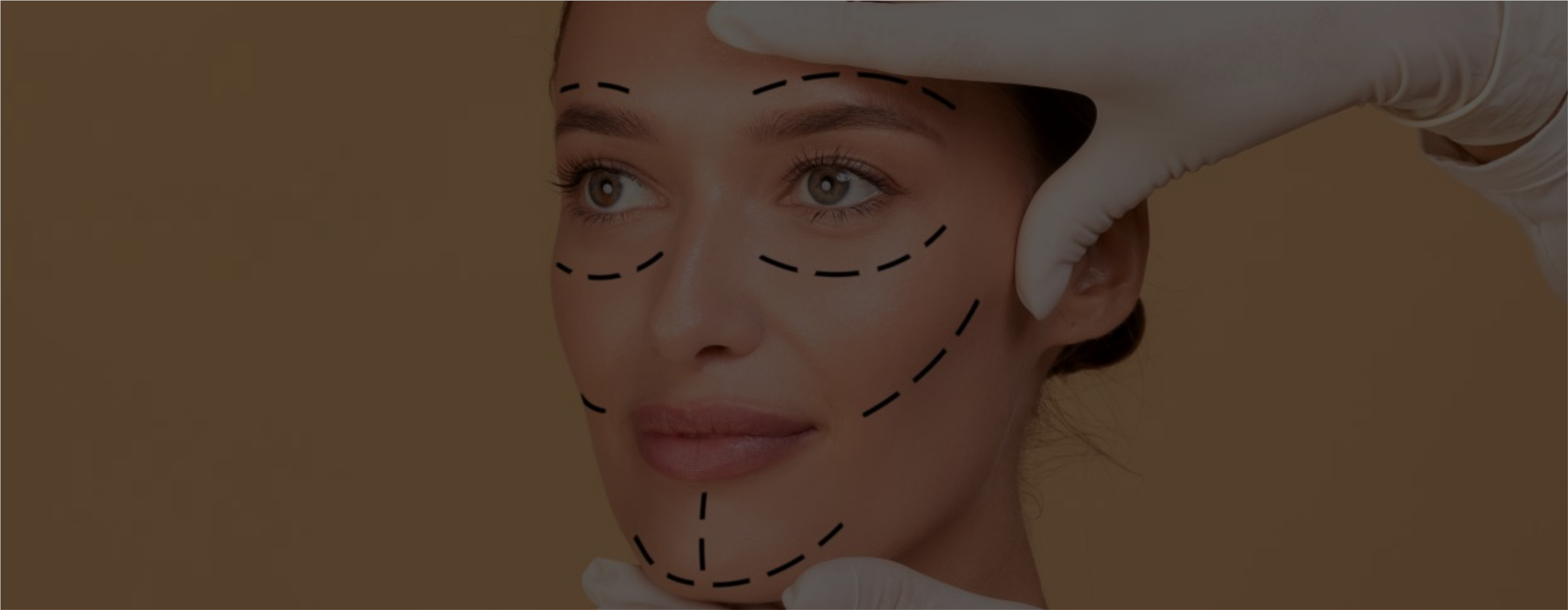Lifting facial
