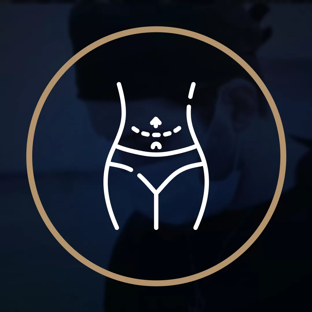 Abdominoplastia