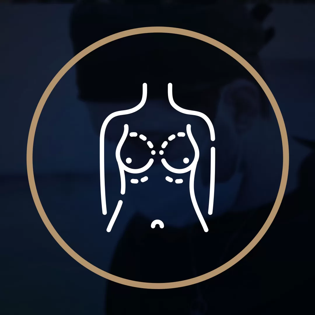 Mamoplastia