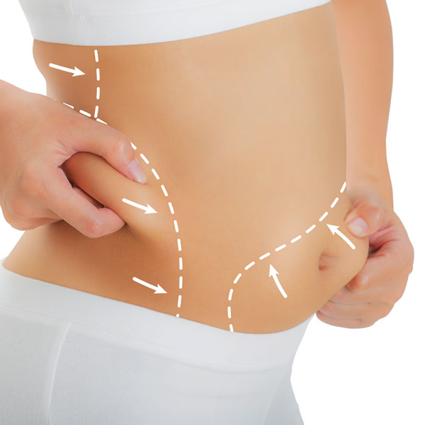 Lipoaspiracao