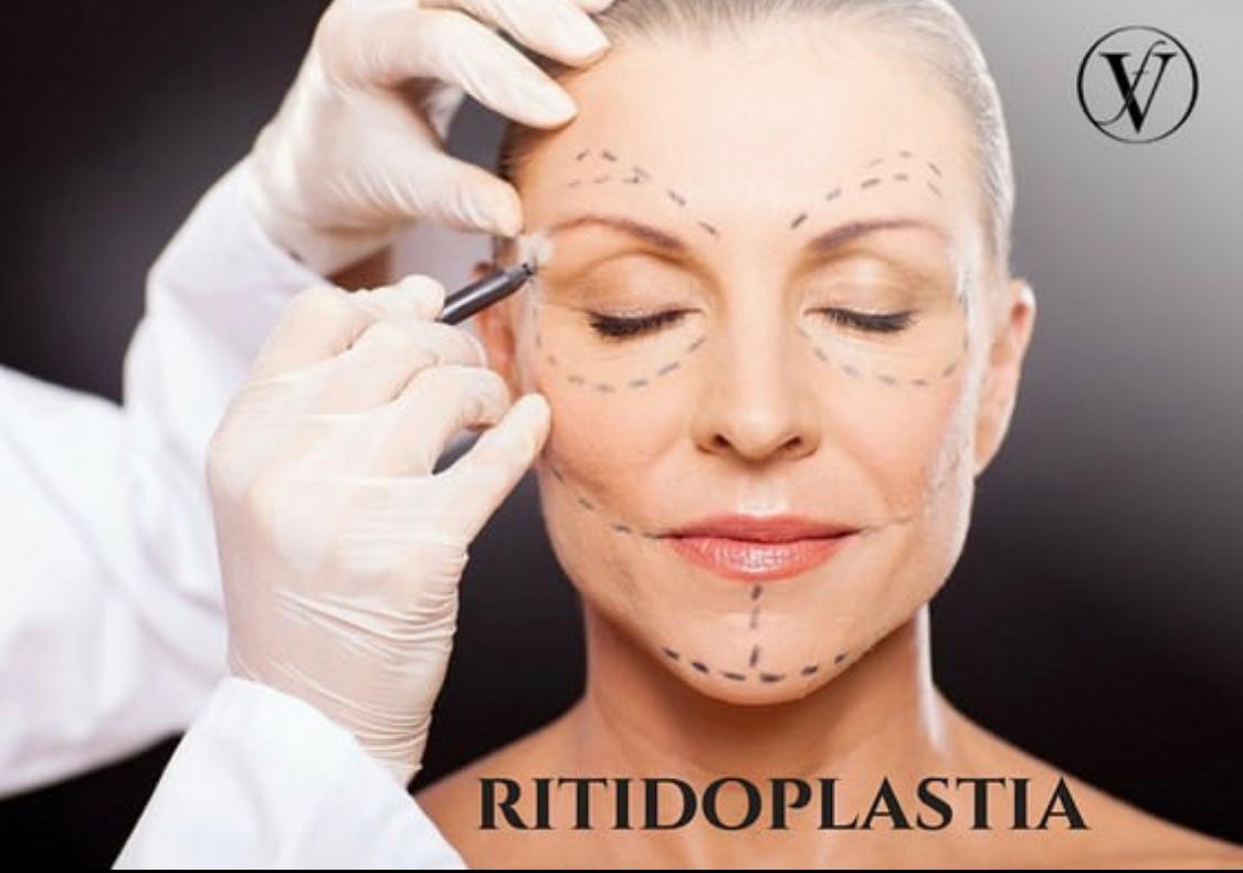 Ritidoplastia