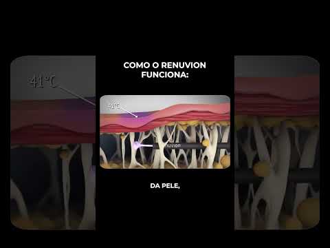 Dra Geovana Brandão - Clínica de Cirurgia Plástica. Renuvion, LipoHD, LipoLAD, Lipoescultura