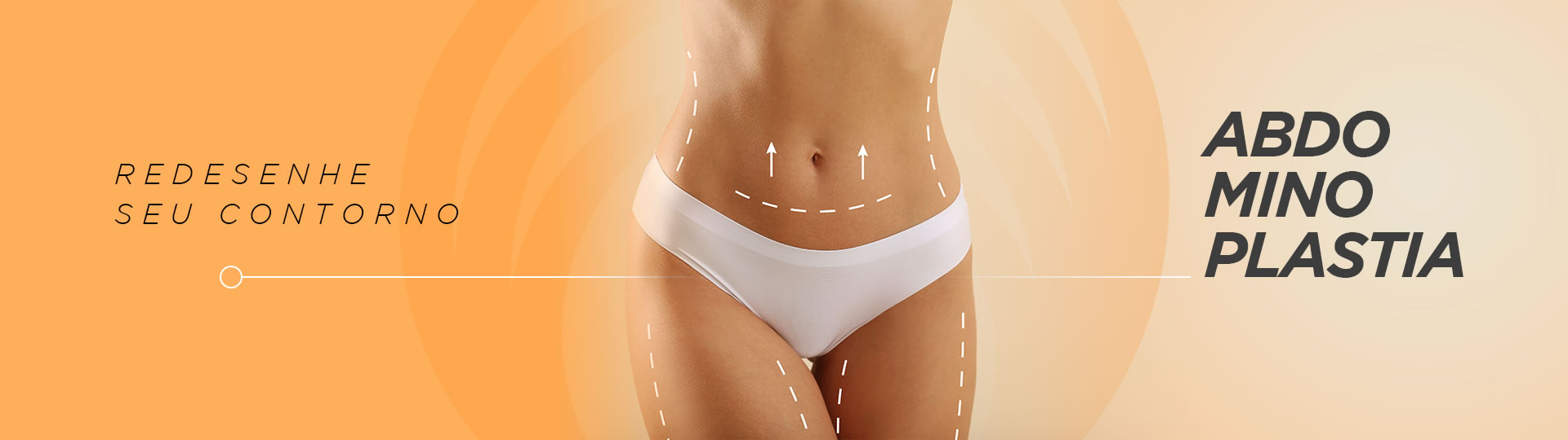 Abdominoplastia