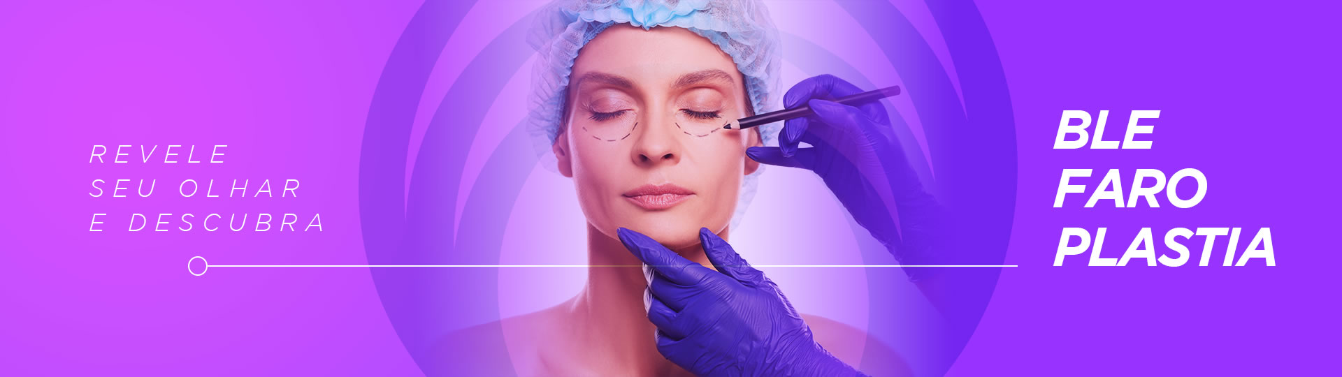 Blefaroplastia