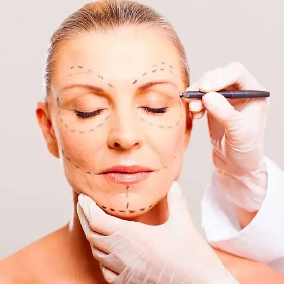 Face e naturalidade