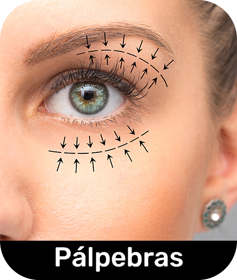 Palpebras